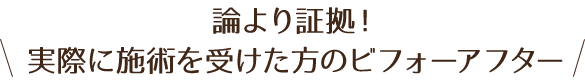 論より証拠!実際に施術を受けた方のビフォーアフター